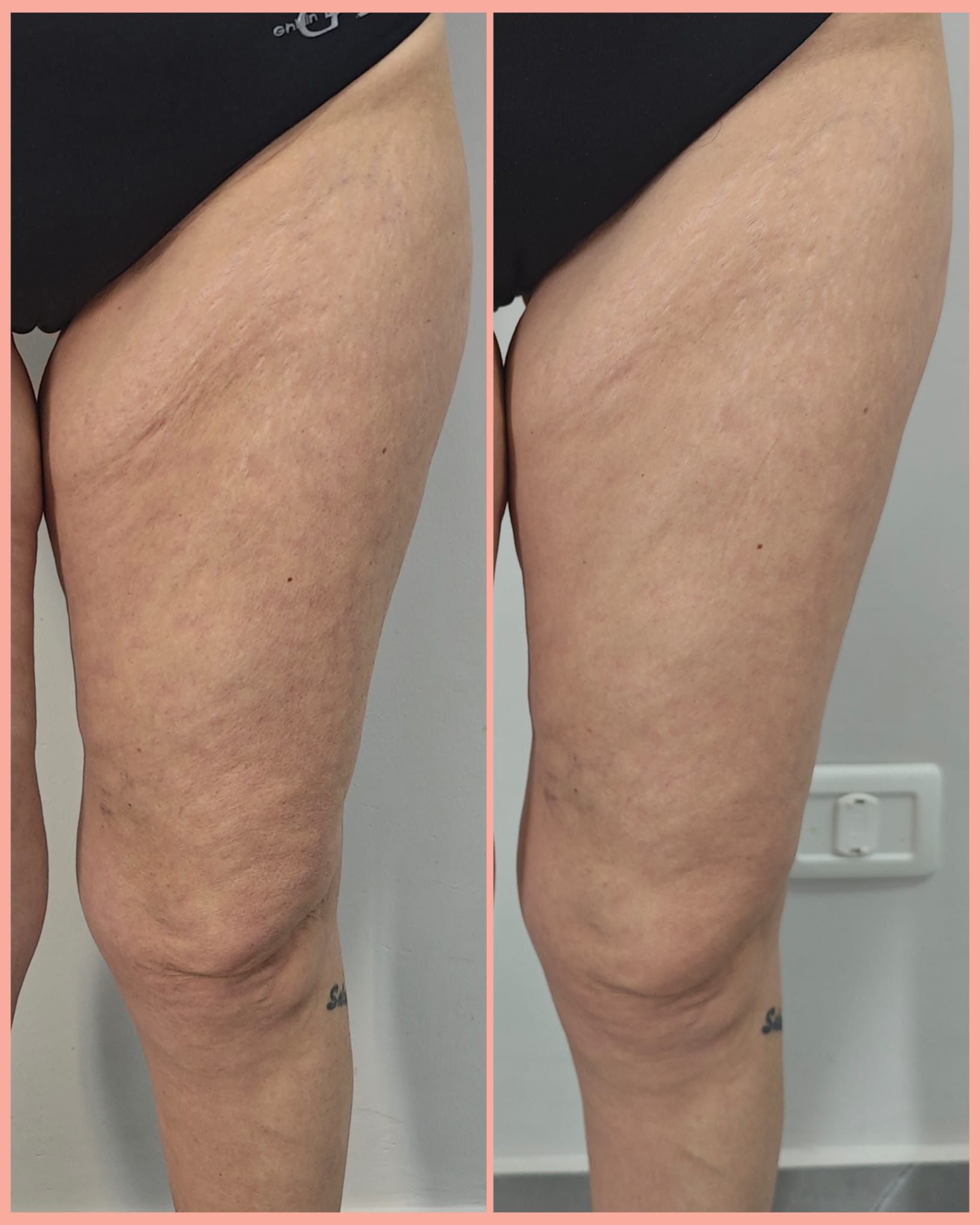 Starter kit : coccole preziose!