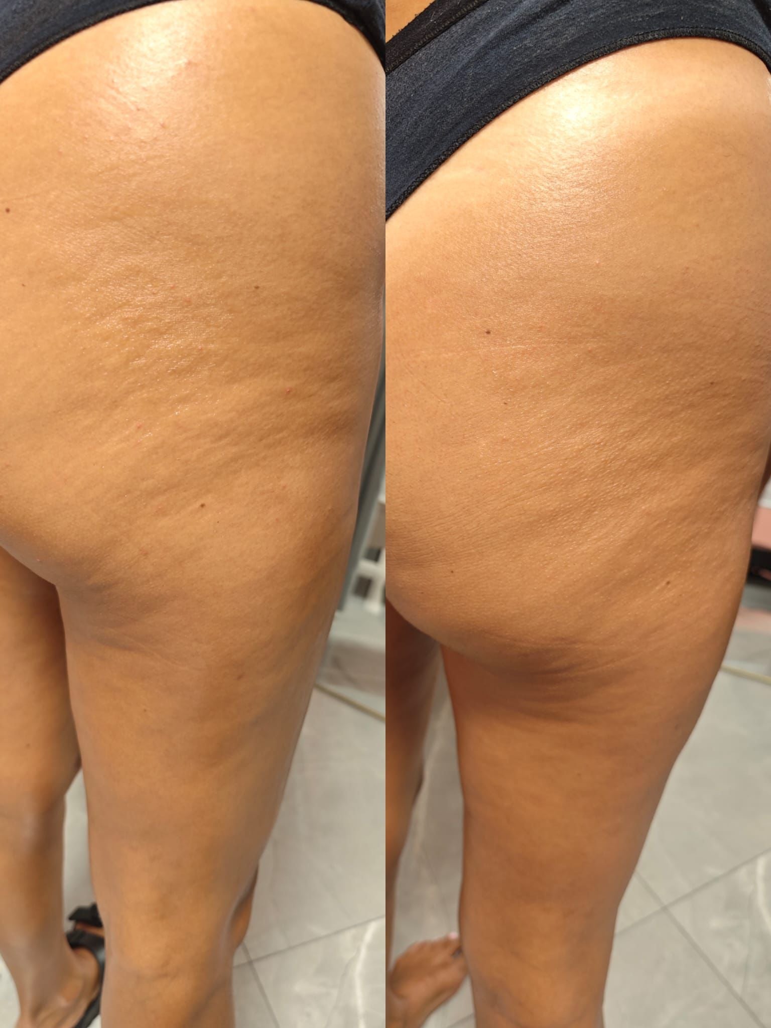 Starter kit : coccole preziose!